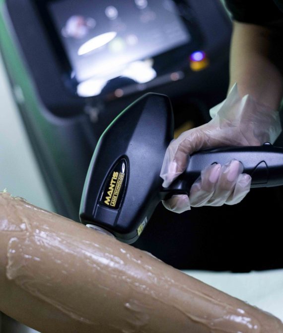 NOVITA’ : EPILAZIONE LASER DOPPIA LUNGHEZZA D’ONDA – CONSULENZA GRATUITA