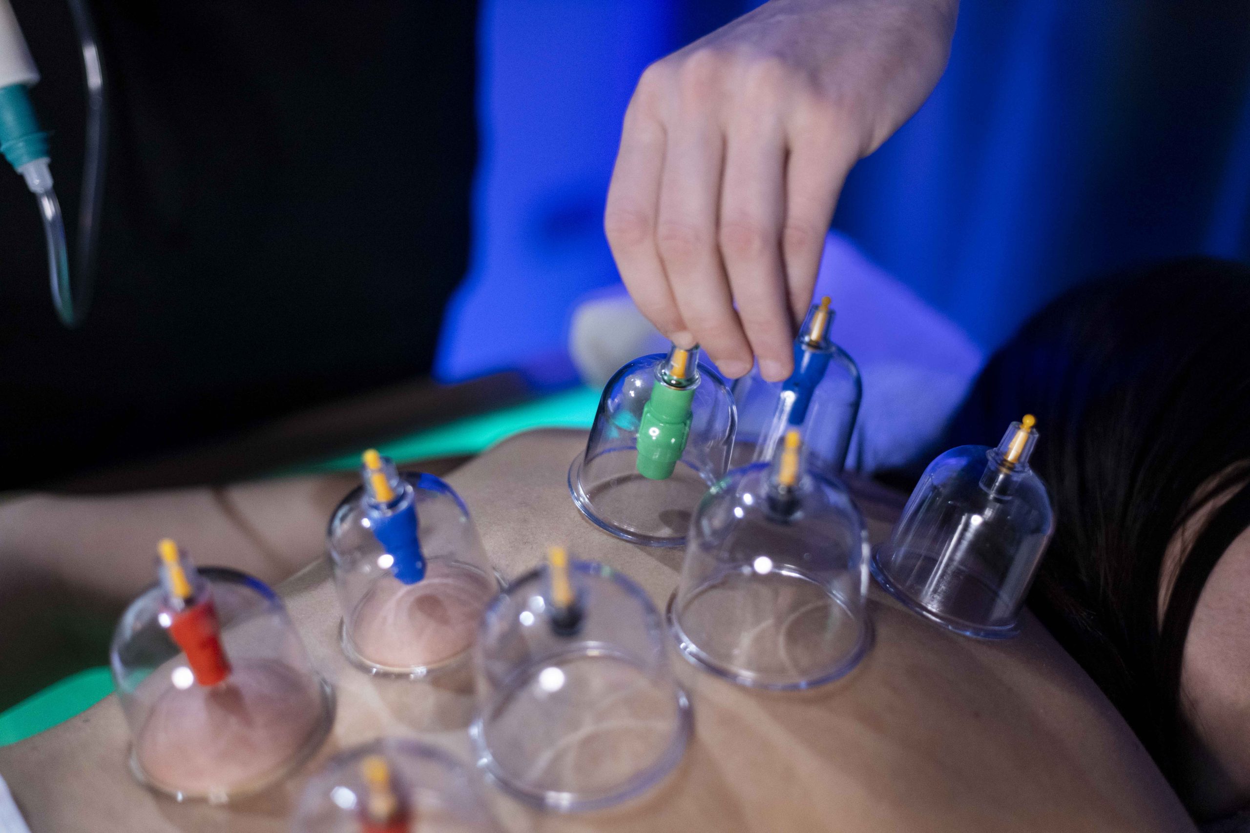 DEEP TISSUE CORPO CON COPPETTAZIONE 50 min. - immagine 3