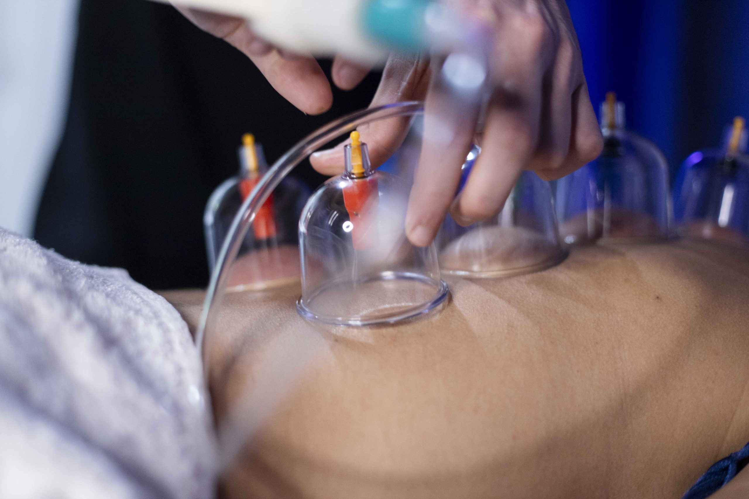 DEEP TISSUE CORPO CON COPPETTAZIONE 50 min. - immagine 8