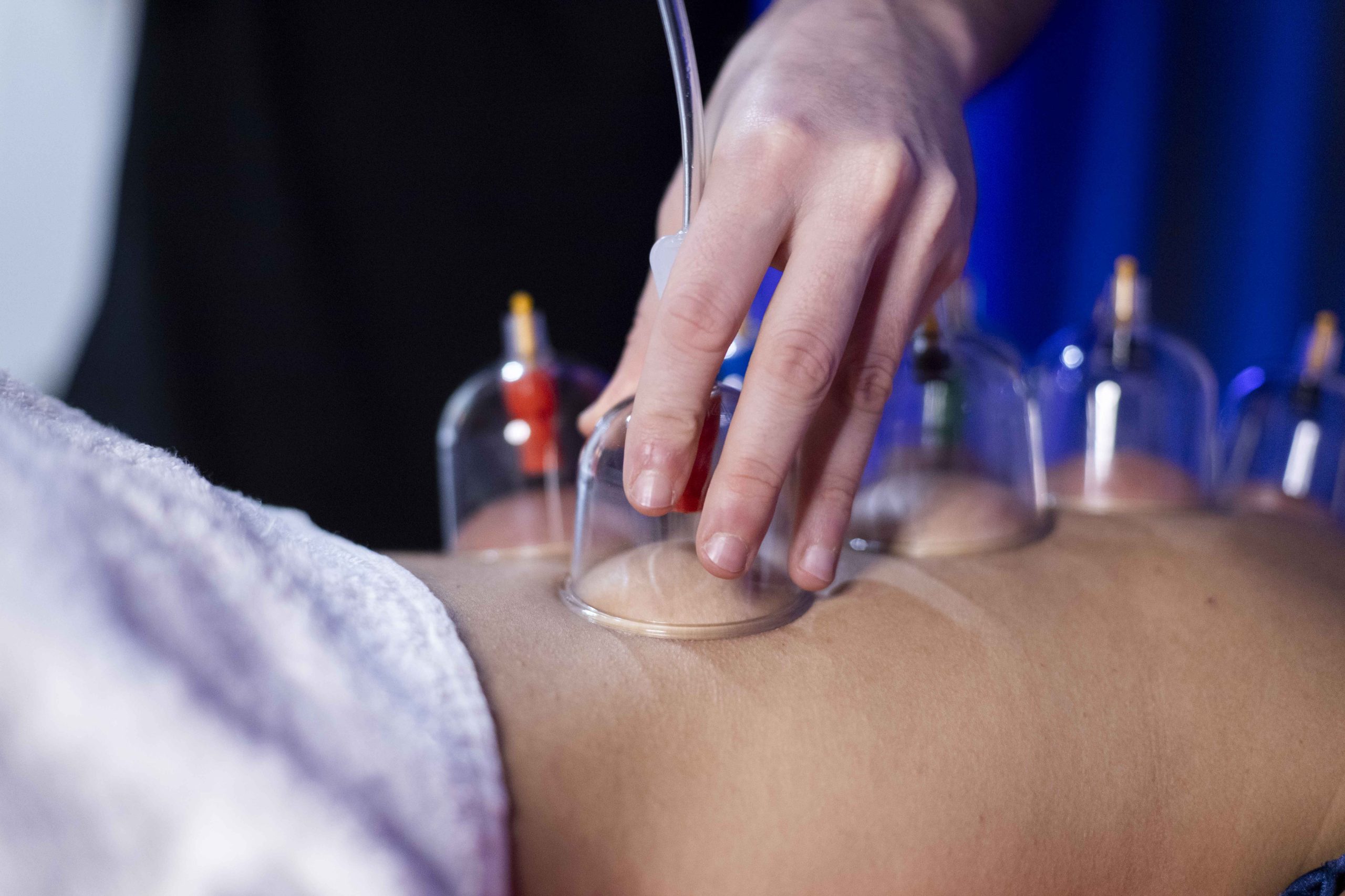 DEEP TISSUE CORPO CON COPPETTAZIONE 50 min. - immagine 6