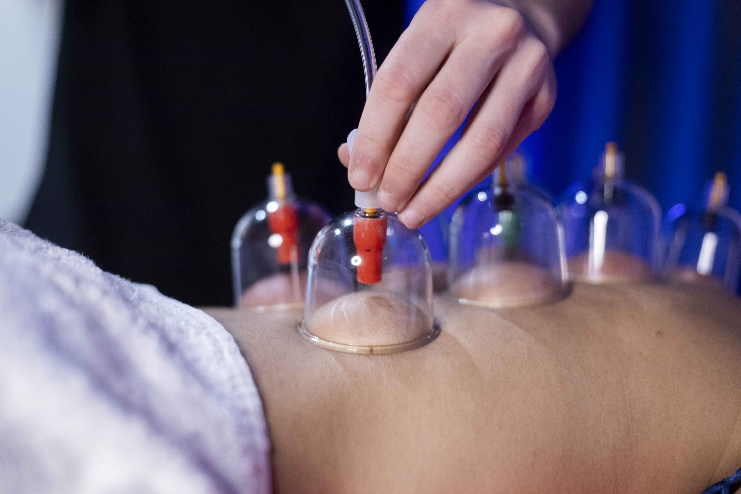 DEEP TISSUE CORPO CON COPPETTAZIONE 50 min. - immagine 9