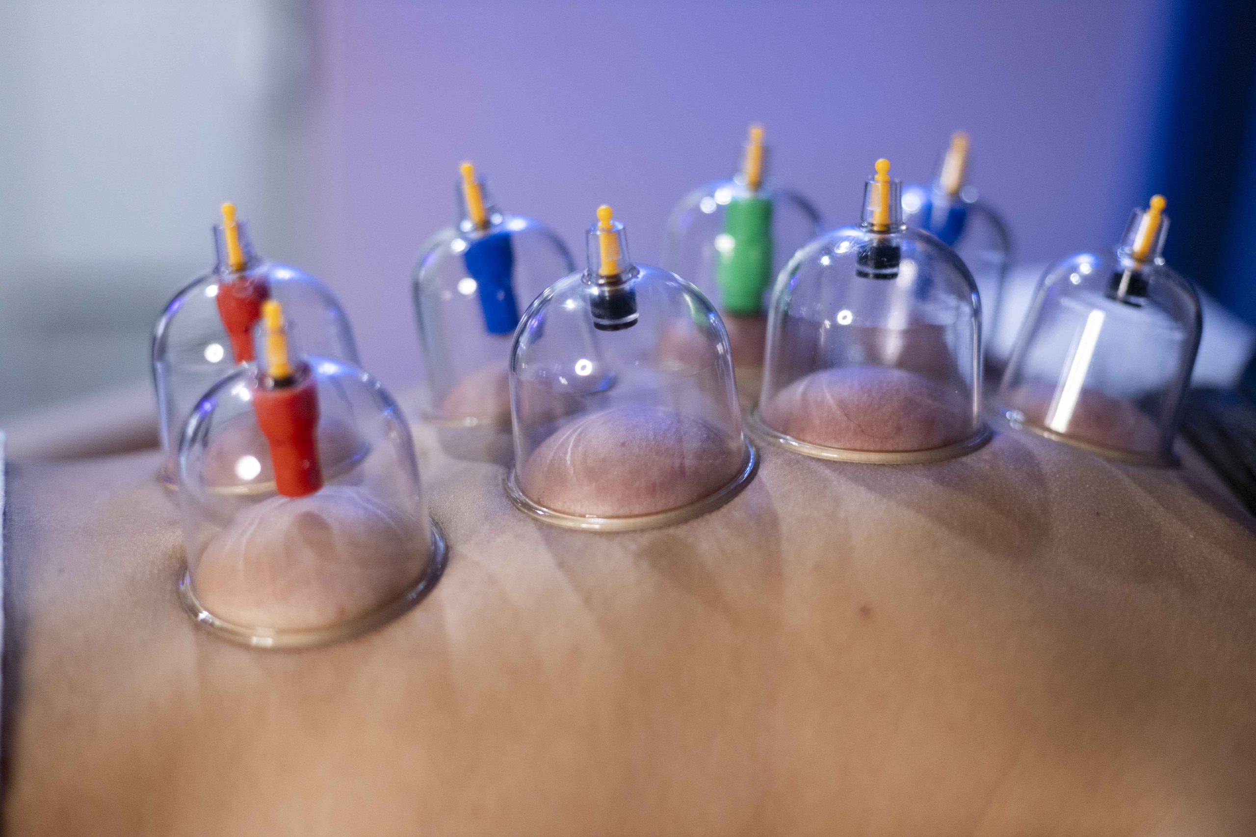 DEEP TISSUE CORPO CON COPPETTAZIONE 50 min. - immagine 10